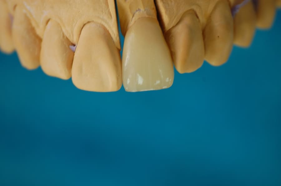Pracownia dentystyczna korona zębowa
